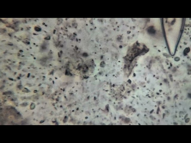 Bacteria in sea foam 400x