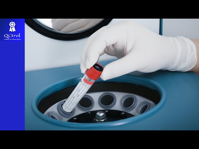 CENTRIFUGATION of Clinical Laboratory samples