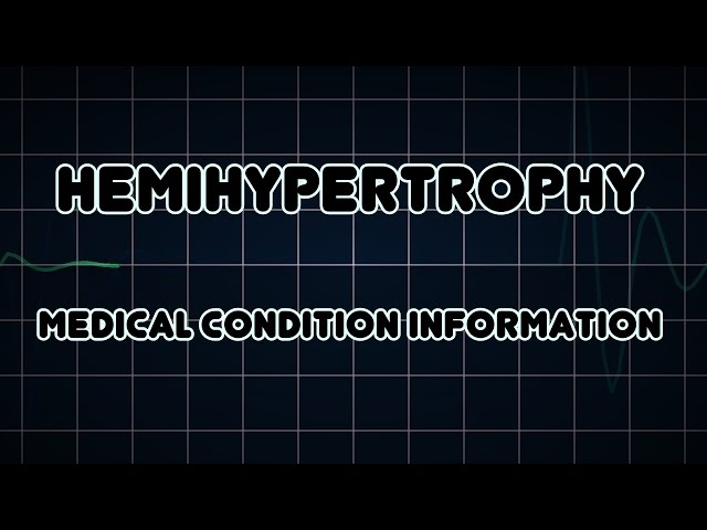 Hemihypertrophy (Medical Condition)