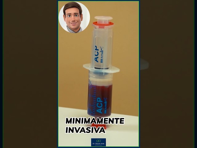 Ventajas del tratamiento con PRP