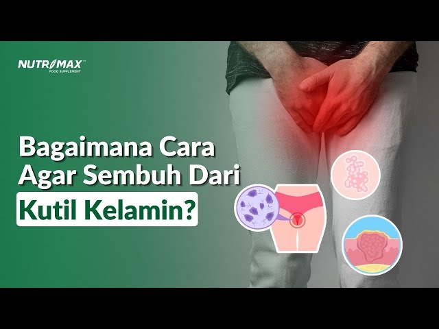 Apakah Kutil Kelamin Bisa Sembuh?