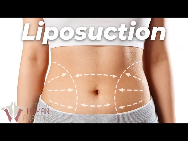 The truth about Liposuction