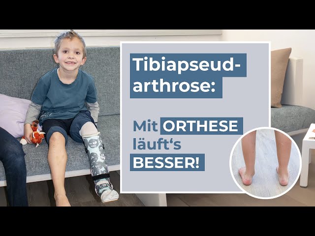 Orthese bei Tibiapseudarthrose - Erik kann wieder springen