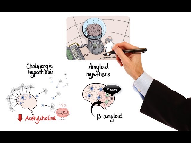 Pharmacology - DRUGS FOR ALZHEIMER'S DISEASE (MADE EASY)