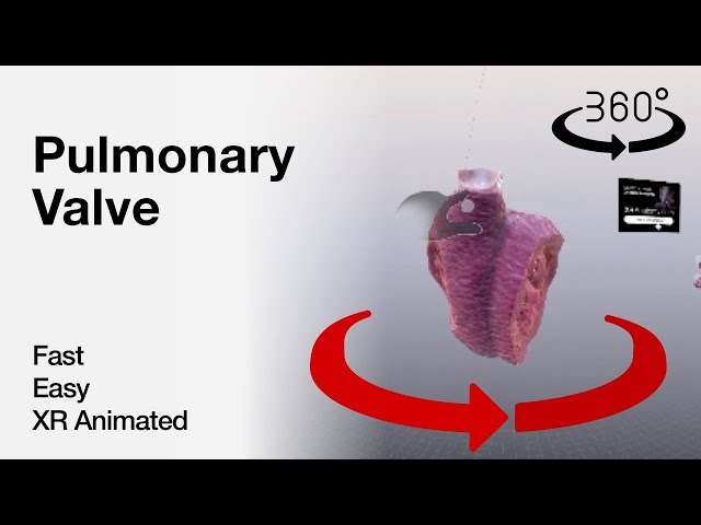 360 video - Pulmonary Valve - Explained in Mixed Reality