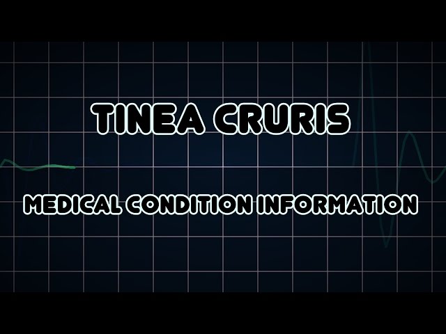 Tinea cruris (Medical Condition)