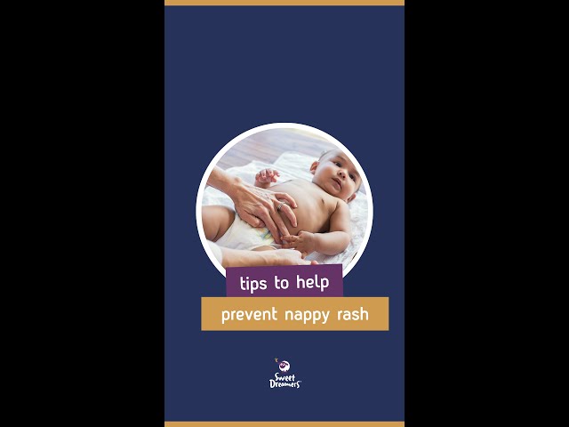 Tips on how to help prevent nappy rash | Quick Tips For New Parents