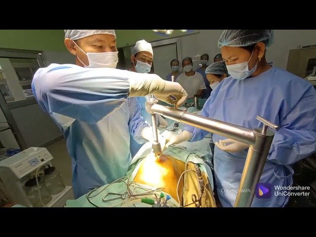 108)  RAIS Device Setup for Gasless Laparoscopy - Dr  Biju Islary