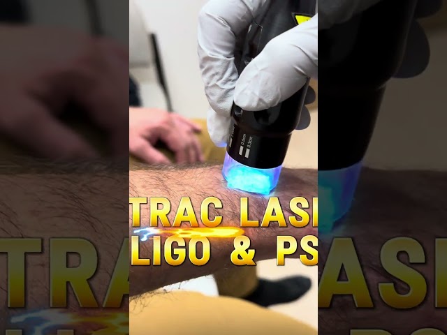 XTRAC Laser for Vitiligo and Psoriasis | Spectrum Dermatology of Atlanta | Roswell, Cumming, GA