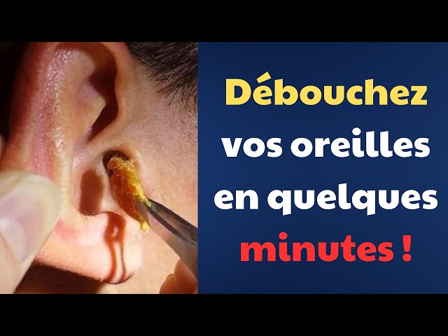 Oreille bouchée : causes et solutions efficaces |Fact24h