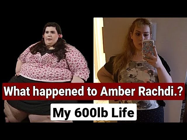 What happened to My 600 lb life Amber Rachdi?