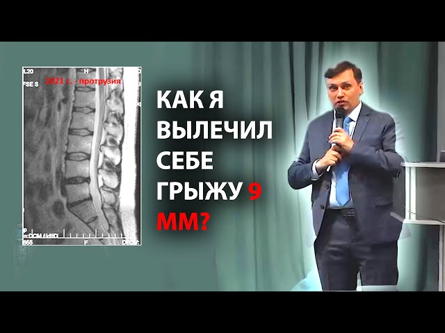 Как я избавился от грыжи 9мм? Лечение грыжи | Отказали ноги в 2006 году. Касимов Искандер НАНМ 23