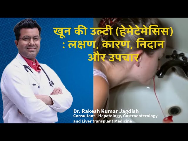 Hematemesis, खून की उल्टी या हेमेटेमेसिस,Ulti me Blood Aane Ke Karan #vomiting #bleeding#anemia