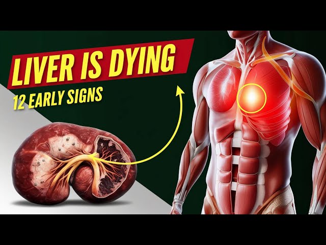 12 Alarming Signs Your Liver is in Danger – Protect Your Health Now!