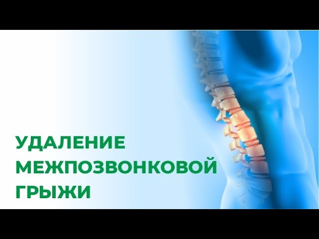 Операция по удалению грыжи диска. Как проходит операция. Что происходит после операции.