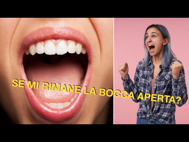 Se mi rimane la bocca aperta?