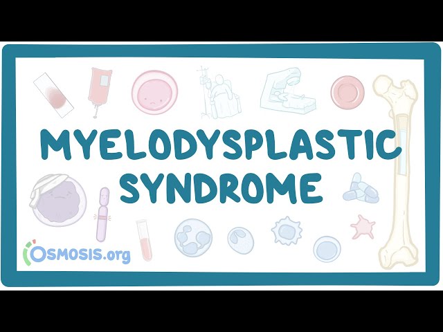 Myelodysplastic syndromes - causes, symptoms, diagnosis, treatment, pathology