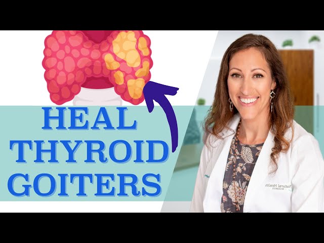 How to SHRINK Thyroid Nodules, Thyroid Cysts and Thyroid Goiters Naturally