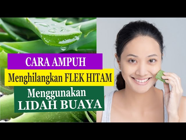 How to Eliminate Black Spots on the Face Using Aloe Vera