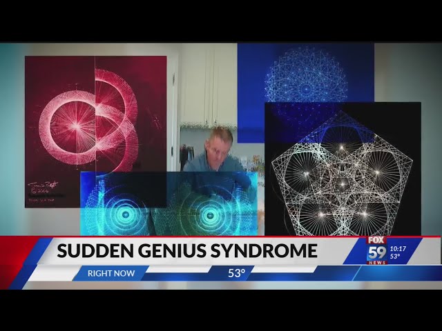 'Sudden genius syndrome' robbery victim uses math to find new home in Indiana