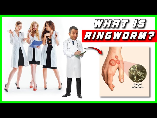 Don't GET Ringworm!