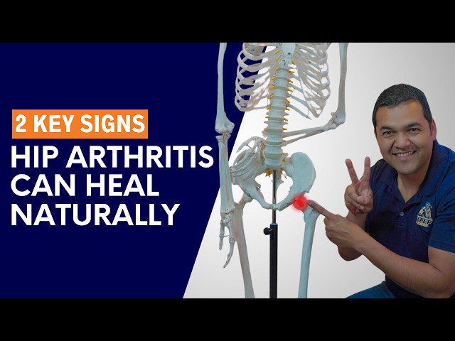 2 Key Signs It Is Possible For Hip Arthritis To Heal Naturally