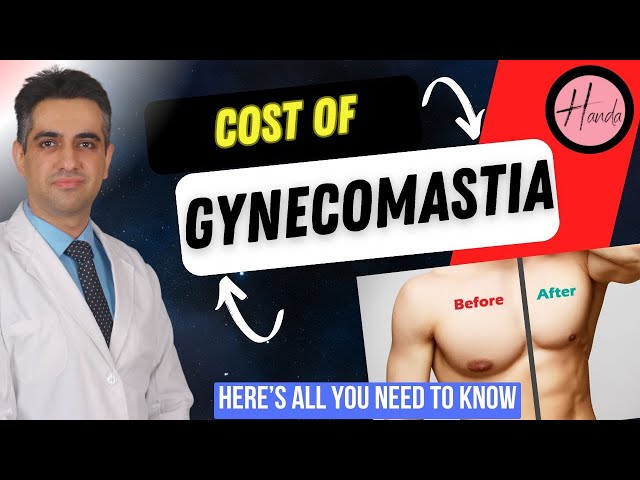 Gynecomastia Treatment Costs Explained by Plastic Surgeon. 4 Grades of Condition