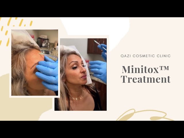 Signature Minitox™ Treatment | Live with Dr. Nadir Qazi