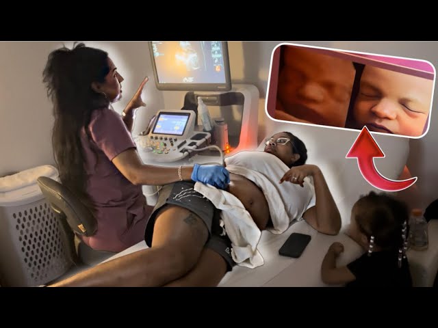 WE DID A 8k REALISTIC ULTRASOUND ON OUR 9TH CHILD | WONT BELIEVE WHAT WE SAW