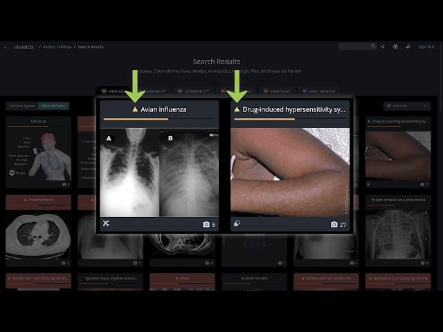 Diagnoses in the Differential View