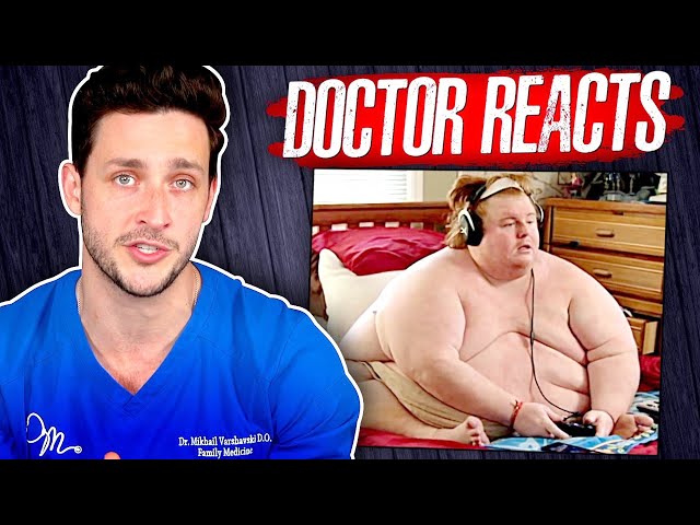 The Harsh Reality Of Being 800 Pounds | Doctor Reacts