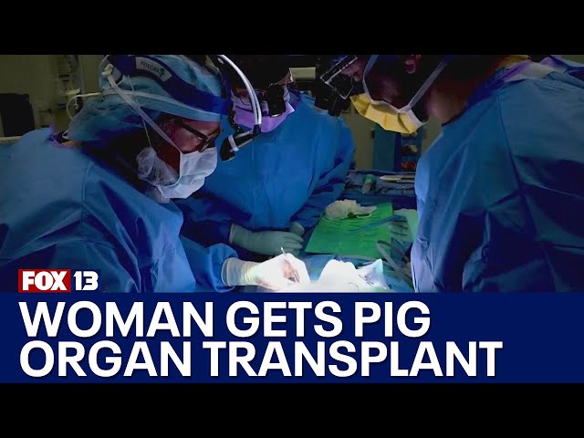 Woman receives experimental pig organ transplant | FOX 13 Seattle