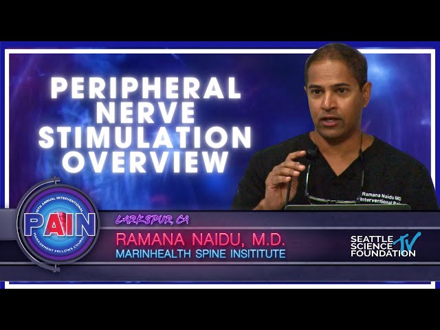 Peripheral Nerve Stimulation Overview - Ramana Naidu, M.D.