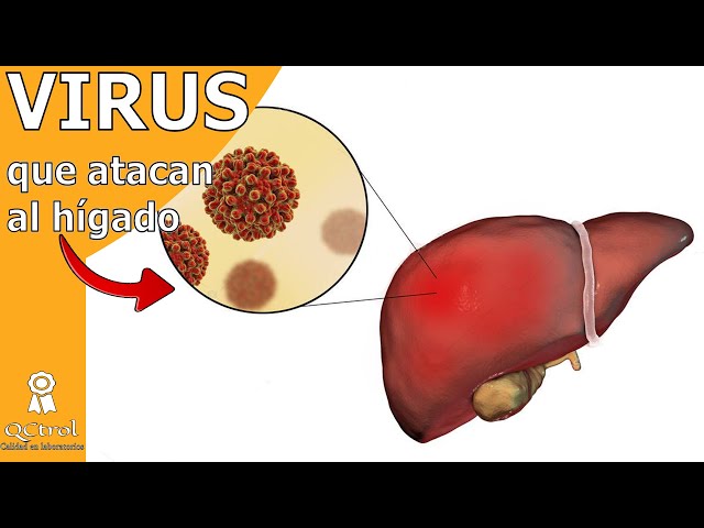 HEPATITIS: VIRUSES that cause it and laboratory TESTS to detect it