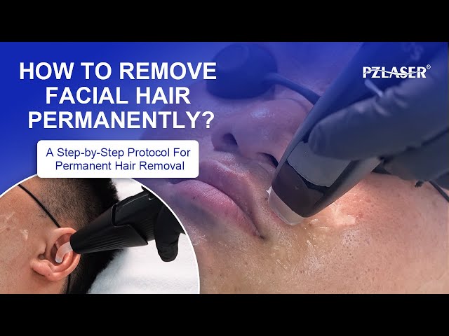 How to Remove Facial Hair Permanently? The Ultimate Guide to Laser Hair Removal with EosICE® Star!