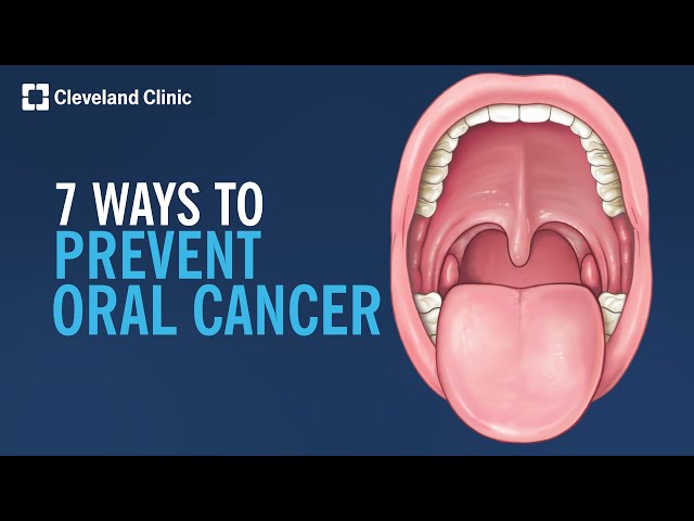 7 Ways to Prevent Oral Cancer