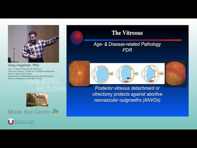 Structure, Function & Pathology of the Choroid-RPE-Retina-Vitreous Complex (Part 2)