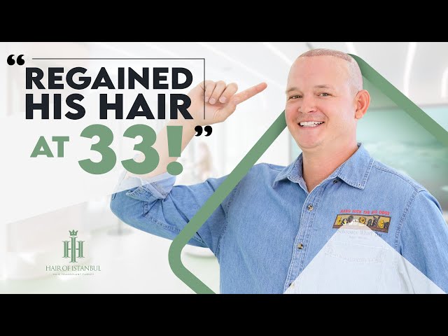 "33 Years Old and Finally Got a Hair Transplant: My Amazing Experience in Turkey | Hair of Istanbul"