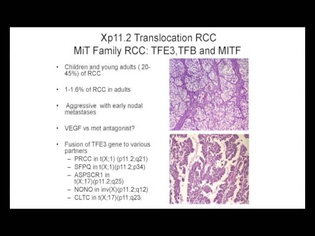 How Does Histology Alter Treatment? Cora N. Sternberg, M.D., FACP