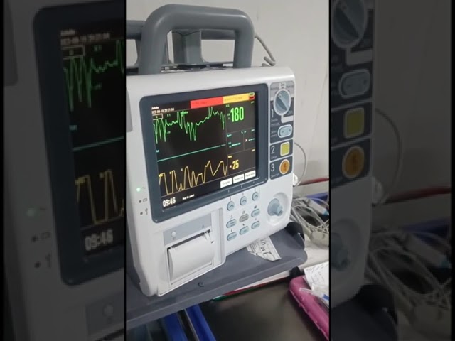 Modified Valsalva maneuver in paroxysmal supraventricular tachycardia