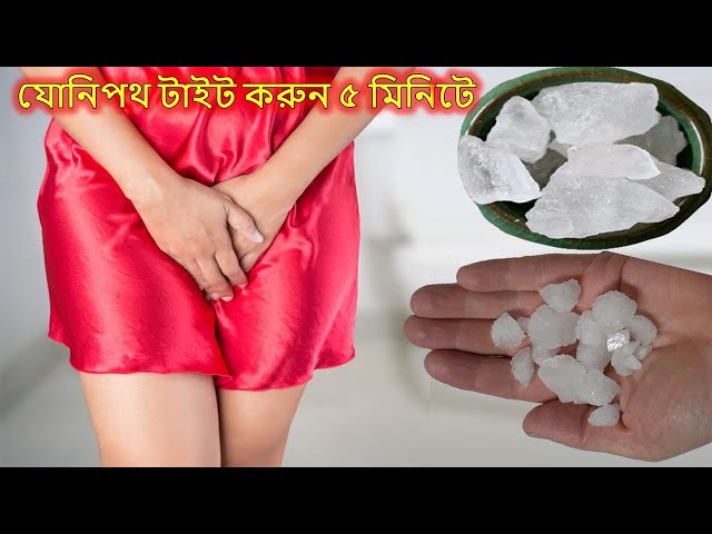 রাতে মাত্র ১০ মিনিট যোনিপথে ব্যবহার করলেই ঢিলে যোনিপথ টাইট ও সুগঠিত হবে | Loosen And Tighten Vagina