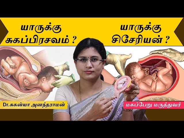 Normal Delivery Or Caesarean Section | யாருக்கு சுகப்பிரசவம்? யாருக்கு சிசேரியன்?