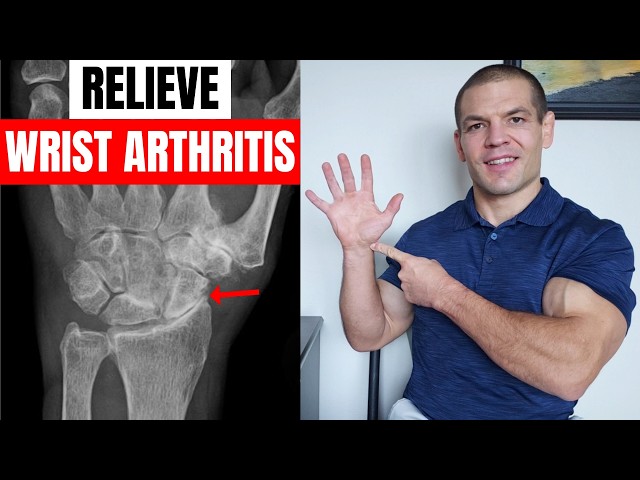 Relieve Wrist Arthritis Pain: 10 Unique Exercises You Haven't Tried!