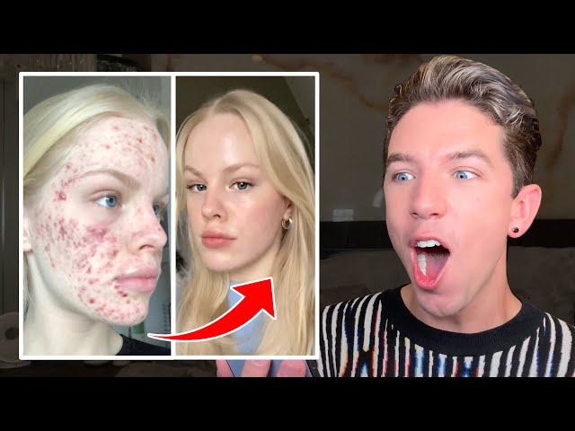 Reacting to Mind-Blowing Skin Transformations!😱