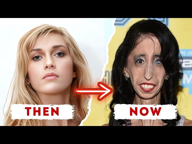 The Secret Behind Perfect Beauty Celebrities Addicted to Plastic Surgery