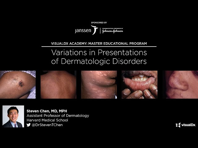 Variations in Presentations of Dermatologic Disorders