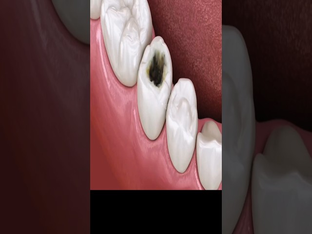 The Magic of Tooth Restoration!