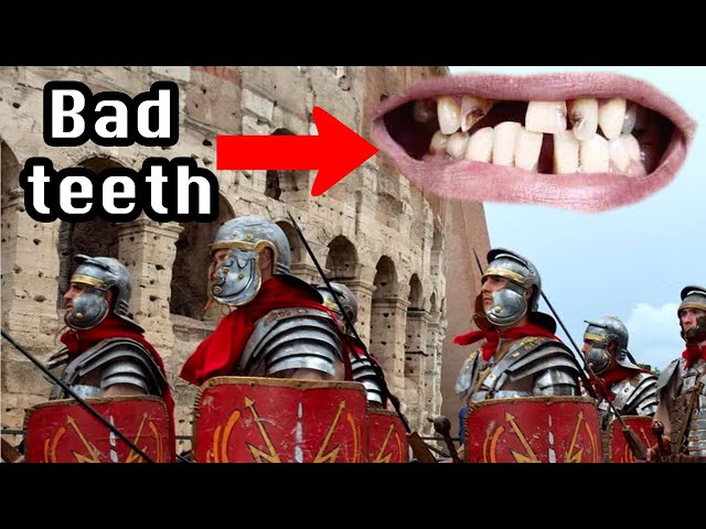 The Romans gave British people bad teeth