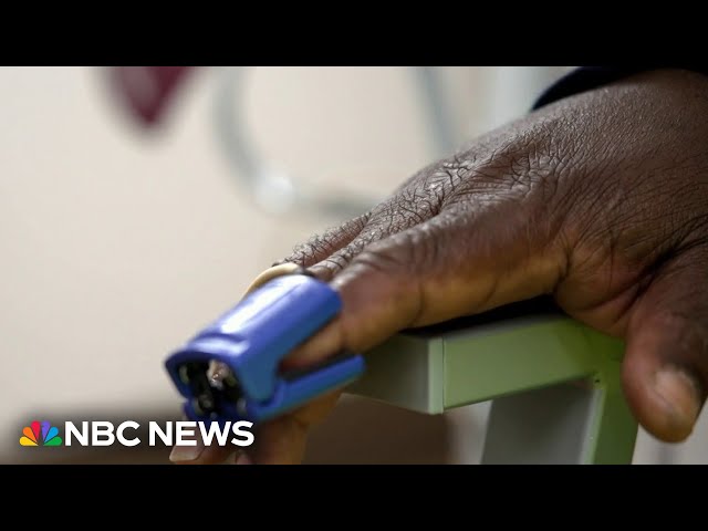 Researchers working to make pulse oximeters work better on all skin colors