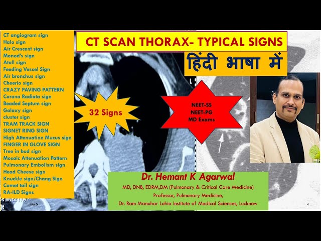 CT SCAN THORAX (हिंदी भाषा में) Typical Named Sign for Exams #NEET SS, #NEET-PG @Dr.Hemant K Agarwal